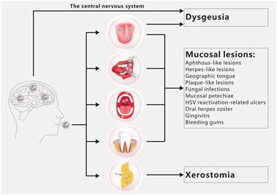 The oral manifestations and related mechanisms of COVID-19 caused by SARS-CoV-2 infection